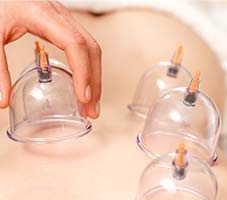 Cupping Milton Physiotherapy