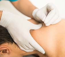 dry Needling Milton Physiotherapy