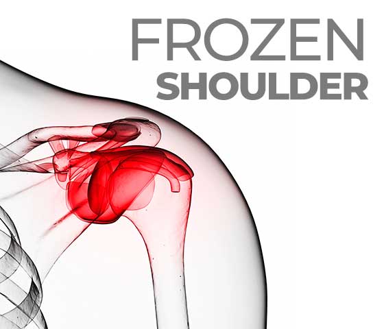 Frozen Shoulder Treatment in Milton ON