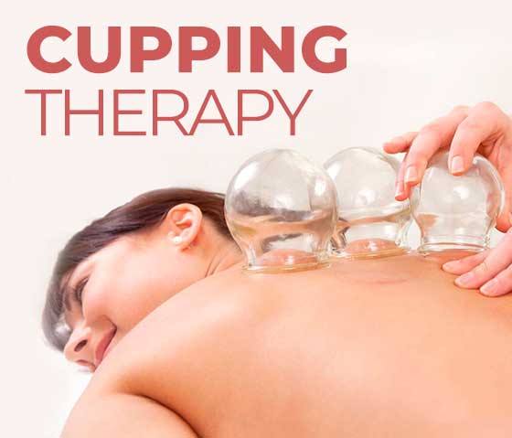 Cupping Therapy Techniques in Milton