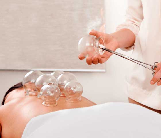 Cupping Therapy in Milton
