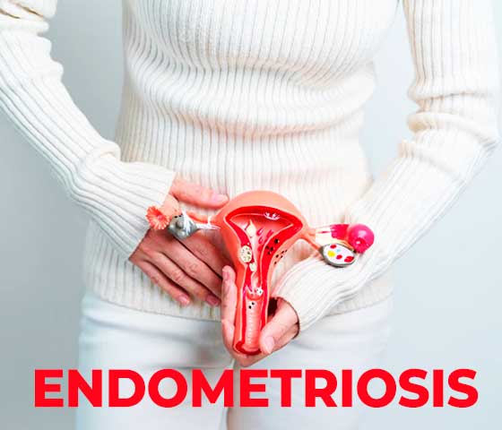 Endometriosis treatment in Milton