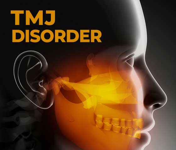 TMJ Dysfuntion