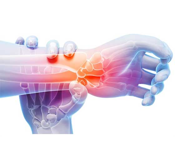 Wrist Physiotherapy in Milton