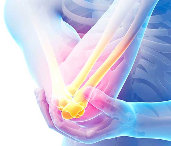 Elbow Physiotherapy in Milton