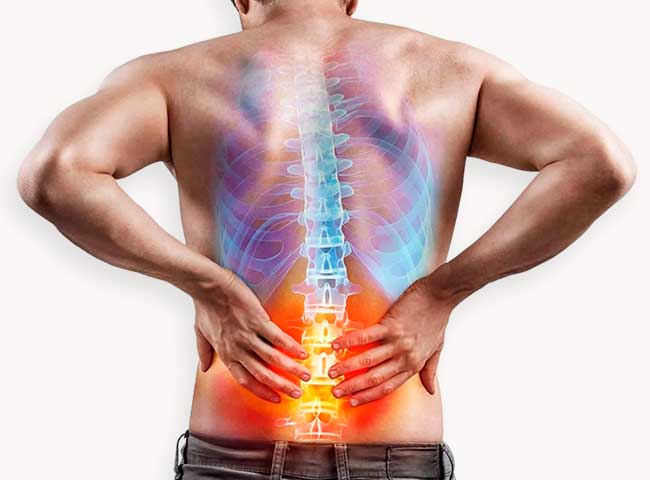 Low back pain physiotherapy in Milton