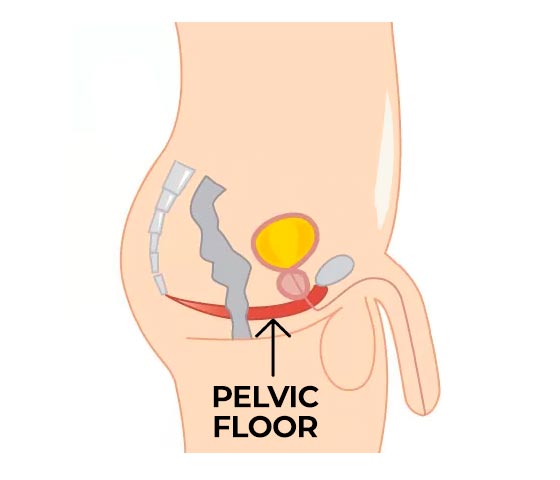Men's Pelvic Floor Physiotherapy in Milton