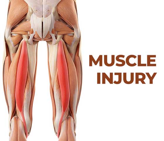 Muscle Injuries Treatment in Milton