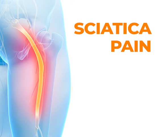 Sciatica Pain Physiotherapy in Milton