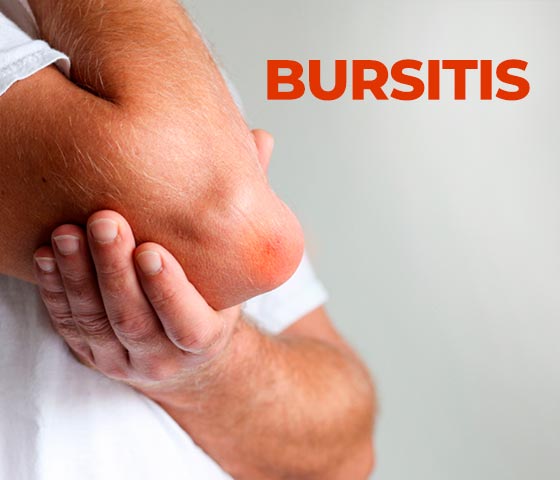 Bursitis Physiotherapy in Milton