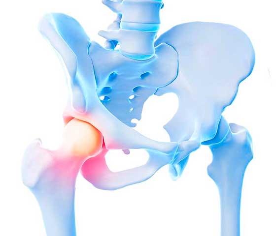 Hip Pain Treatment in Milton