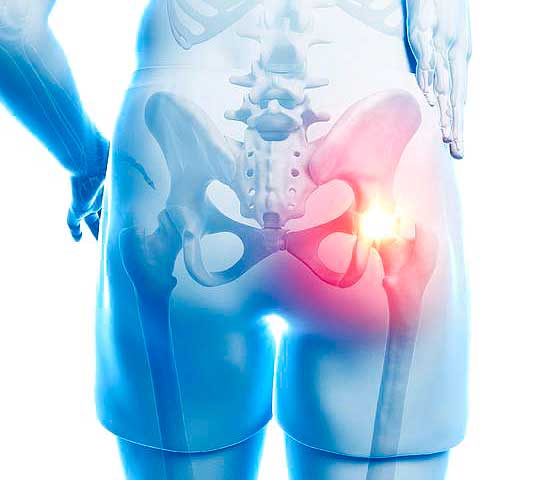 Hip Pain Treatment in Milton