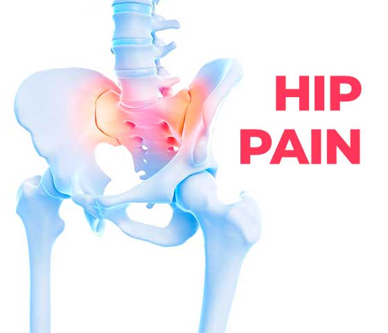 Hip Pain Treatment in Milton